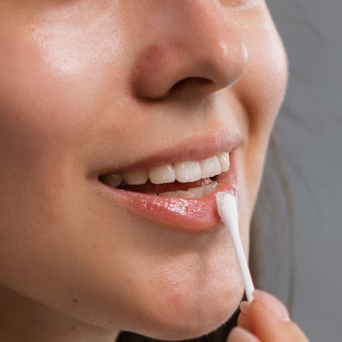 Nazorg PMU Lippen - Melissa Beauty Utrecht