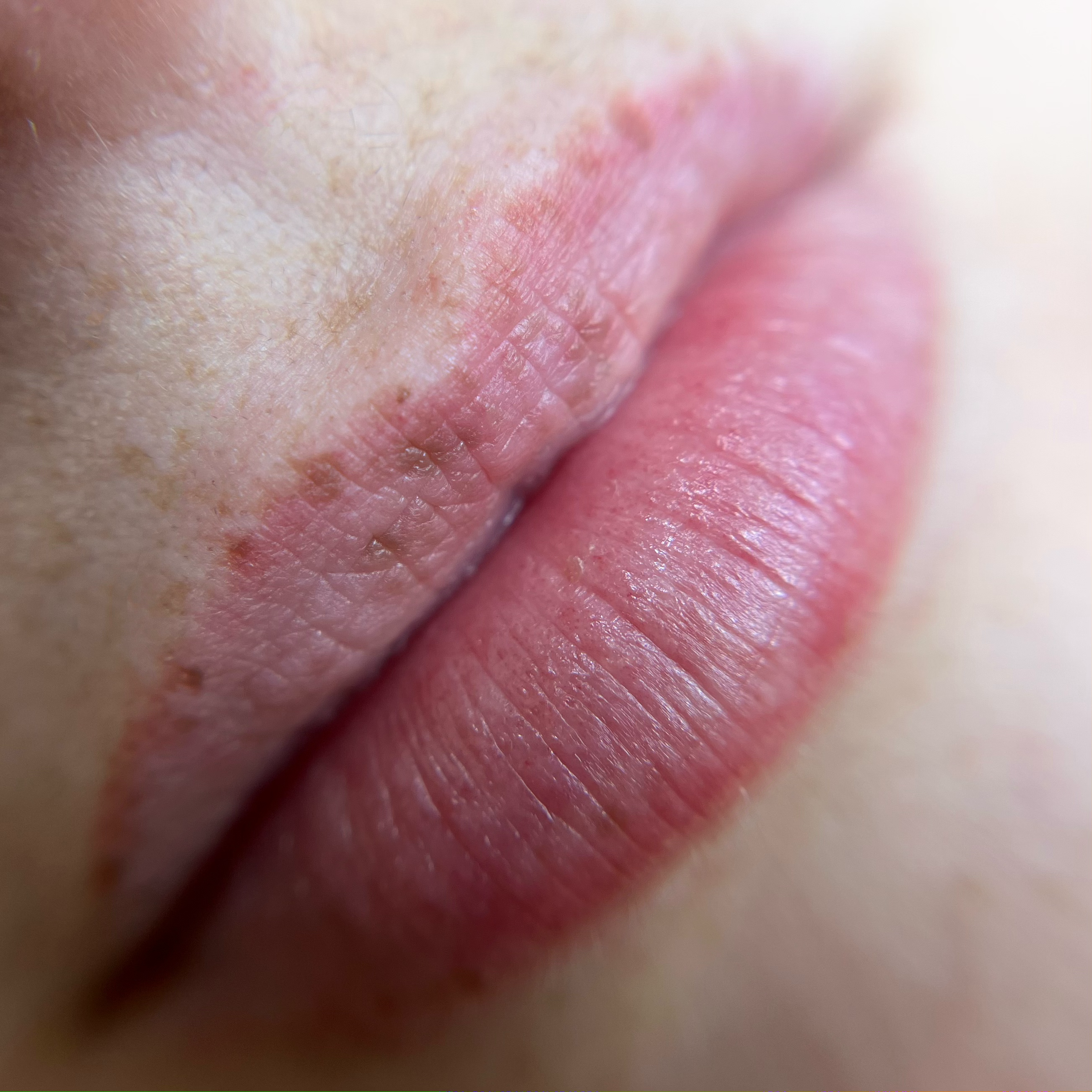 Voor Lip Pigmentatie – Melissa Beauty Utrecht Voor Lip Pigmentatie - Melissa Beauty Utrecht